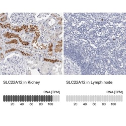 SLC22A12 Antibody, Novus Biologicals 0.1mL; Unlabeled:Antibodies, Polyclonal
